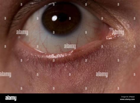 Stye Hi Res Stock Photography And Images Alamy