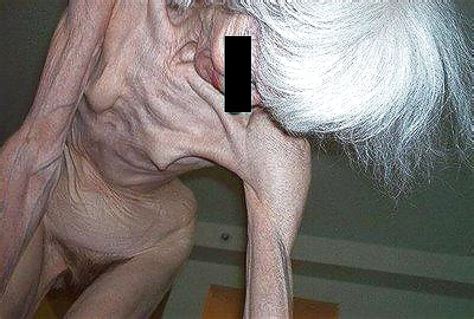 Extremely Skinny And Very Old Hairy Granny Porn Pictures Xxx Photos