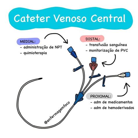 Enfermagem Em Foco On Instagram O Cateter Venoso Central Cvc Tamb M Chamados De Acesso