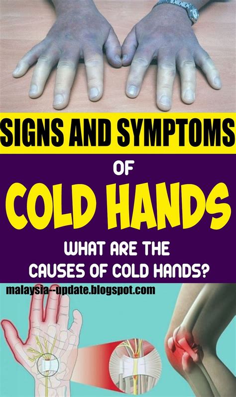 My Hands And Feet Are Always Cold — Should I Worry Medicine Health Life