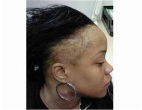 Yes Why Black Women Lose Their Hair Thyblackman Com