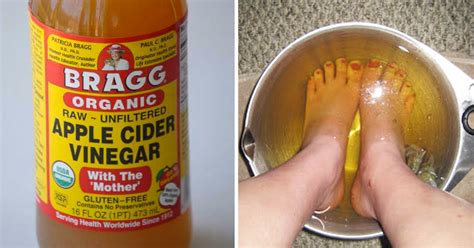 If You Soak Your Feet In Apple Cider Vinegar This Is What Happens