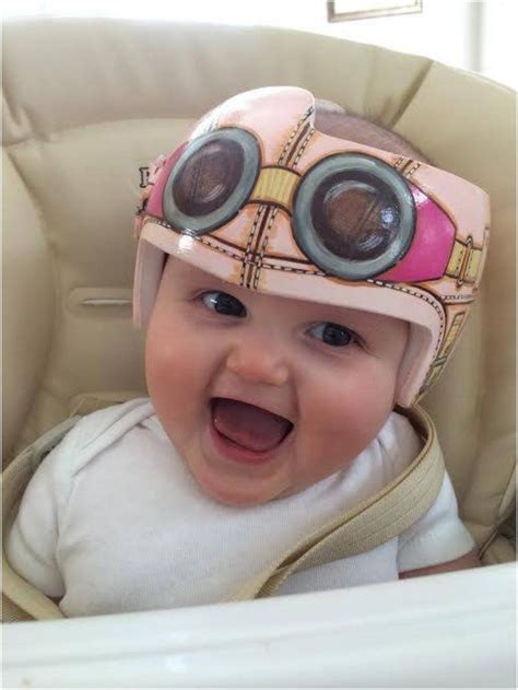 20 Cute And Fun Helmets For Babies With Plagiocephaly Fun Helmets