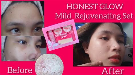 Honest Glow Rejuvenating Set Honest Review Marymerlyn Philippines
