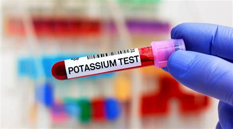 Potassium Deficiency Causes Signs And Treatment Healthkart