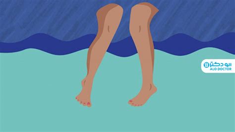 درمان عرق سوز شدن لای پا و کشاله ران چیست الو دکتر