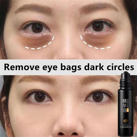 Eye Serum For Dark Circle Eyebag Anti Wrinkle Eye Cream Anti Aging