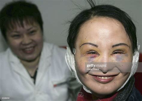Chinese Woman Zhang Jing Known As The Ugly Girl Smiles After News Photo Getty Images
