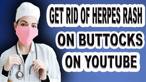 Get Rid Of Herpes Rash On Buttocks On Youtube Youtube