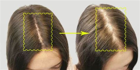 Your Hair Parting Might Be The Cause Of Your Hair Breaking Falling And