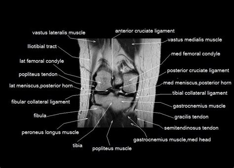 Knee Muscle Anatomy Mri Sagittal Mri Scan Of The Knee Showing The
