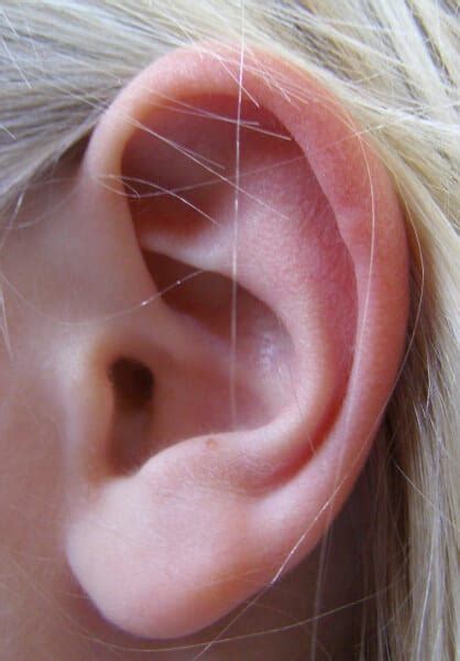 How Much Does Elf Ear Surgery Cost In 2022