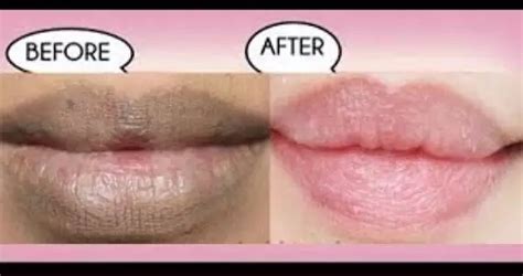 Comment Rendre Ses Lèvres Rose Naturellement - 10 Minutes, 2 Ingrédients Et Vos Lèvres Deviennent Roses