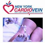 Photos of Vein Treatment New York