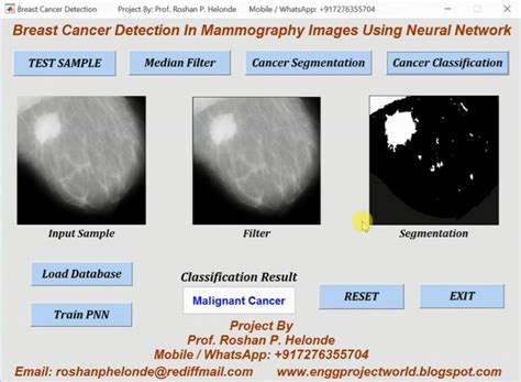 Breast Cancer Detection In Mammography Images Using Neural Network