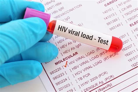 Our Goal Undetectable Viral Load ~ Living With Hiv In The Philippines