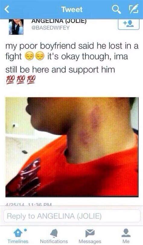 guy comes home with hickeys on his neck and tells his girlfriend he got in a fight she then