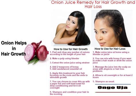 Ongo Uja Using Onions For Speedy Hair Growth Amazing