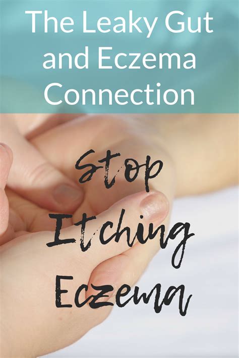 The Eczema And Leaky Gut Connection Eczema Remedies Leaky Gut