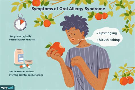 Oral Allergy Syndrome Symptoms And Treatment Gambaran