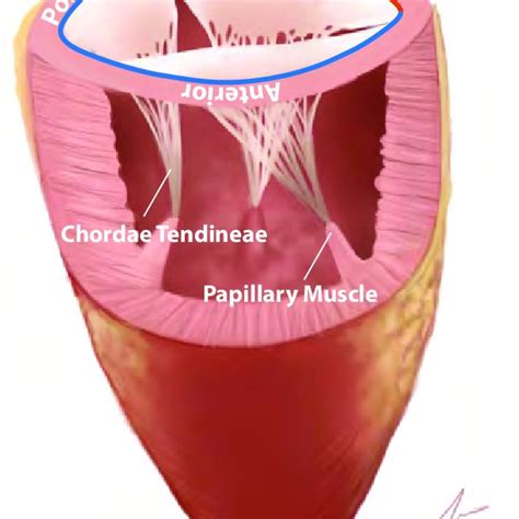 Schematic Of The Right Ventricular Complex With Tricuspid Valve