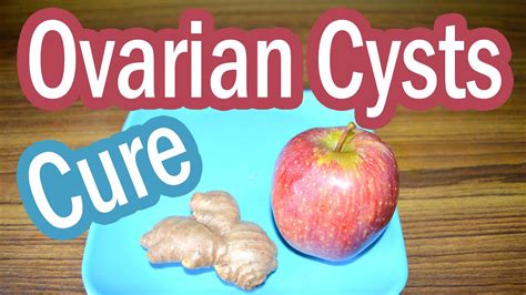 what are first symptoms and the top 3 home remedies for ovarian cysts