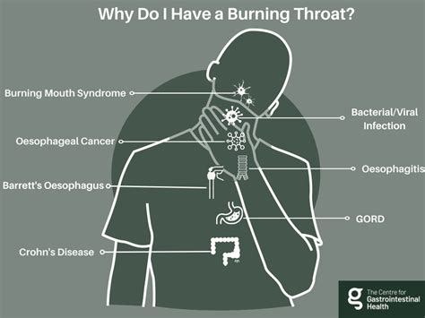 Burning In Throat Causes And Remedies Centre For Gi Health
