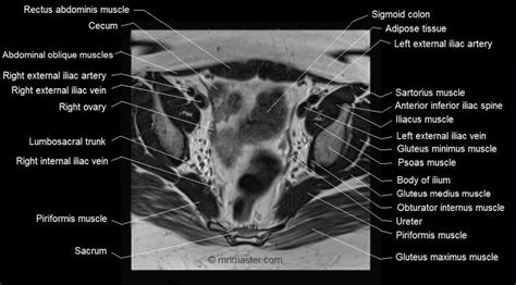 Mri Female Pelvis Anatomy Axial Image 14 Psoas Muscle Muscle Body