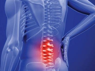 Understand homeopathy treatment for slipped disk & the best homeopathic medicine for slipped disk with doctor bhatia. HOMEOPATHY IN KOLHAPUR|homeopathic Clinic:HOSPITAL:Doctor ...