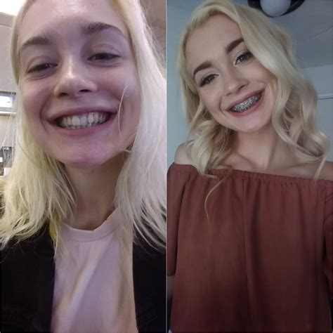 [anastasia Knight 18] Anyone Looking Forward To Some Brace Face And Teen Themed Porn From Her