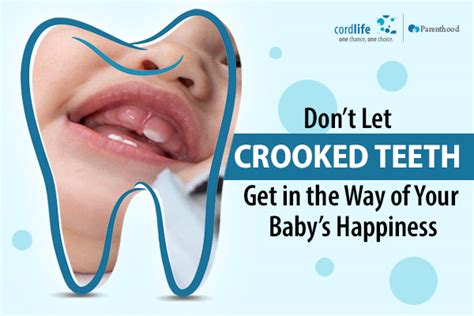 Crooked Baby Teeth Nutrition Adalberto Mccue
