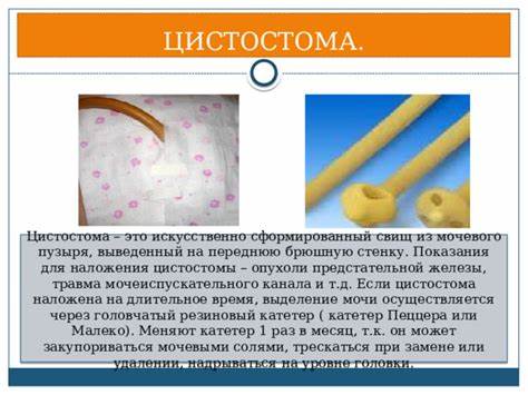 Презентация "Стома. Уход за стомой." Картинка - Презентация "Стома. Уход за стомой."