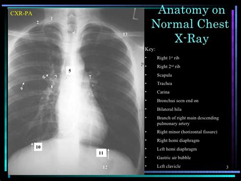 31 Chest X Ray Label Labels Design Ideas 2020