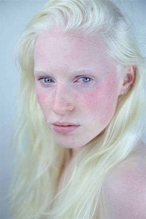 I Took A Picture Of A Beautiful Girl With Albinism Modelo Albino Rostos Humanos Beleza Do Rosto