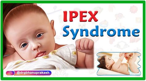 Ipex Syndrome Immunodysregulation Polyendocrinopathy Enteropathy X