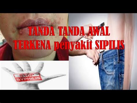 Simptom dan tanda yang selalu berlaku kepada pesakit batuk kering adalah TANDA TANDA AWAL TERKENA penyakit SIPILIS - YouTube