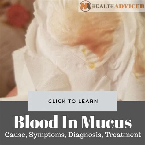 Blood In Mucus Causes Picture Symptoms And Treatment