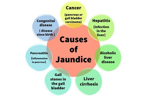 Diet For People With Jaundice - PORTAL MyHEALTH