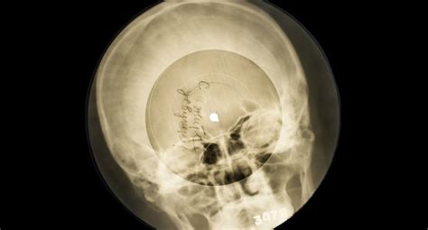 The Bone Records From Ussr Vinyl Records On X Ray