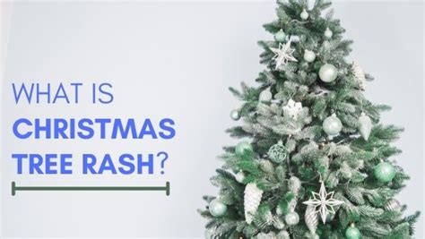 What Is Pityriasis Rosea Or Christmas Tree Rash Causes And Symptoms