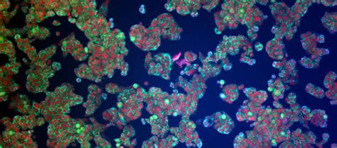 Cancer Cell Lines Predict Drug Response Wellcome Sanger Institute