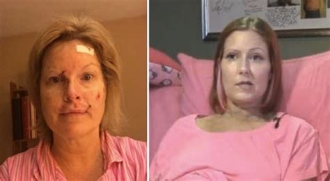 After Years Of Tanning Her Dying Wish Is To Save Others