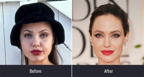 Before And After Celebrities Non Nude Pics Xhamster Hot Sex Picture