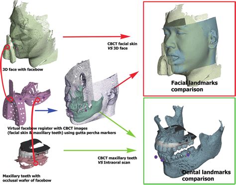 Comparison Of Facial And Dental Landmarks Between Virtual Patient Model