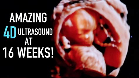 Amazing 4d Ultrasound And Gender Reveal At 16 Weeks Pregnant Baby
