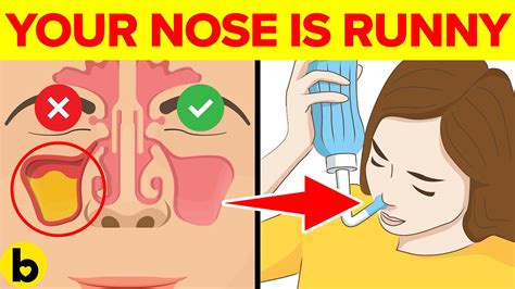 9 Reasons Why Your Nose Keeps Running Youtube