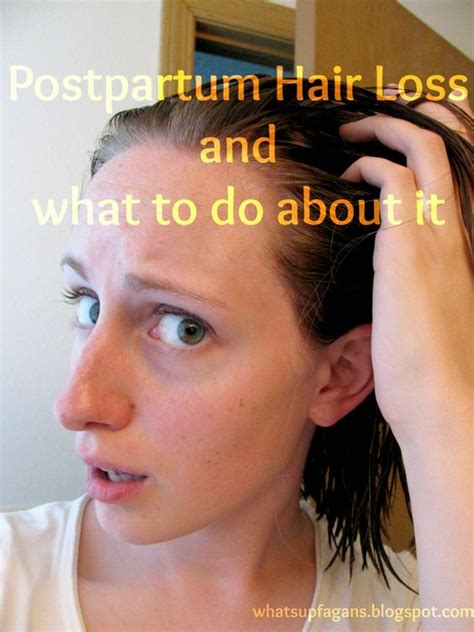 Hereditary hair loss with age is the most common cause of baldness. Postpartum hair loss, What is postpartum and Hair loss on ...