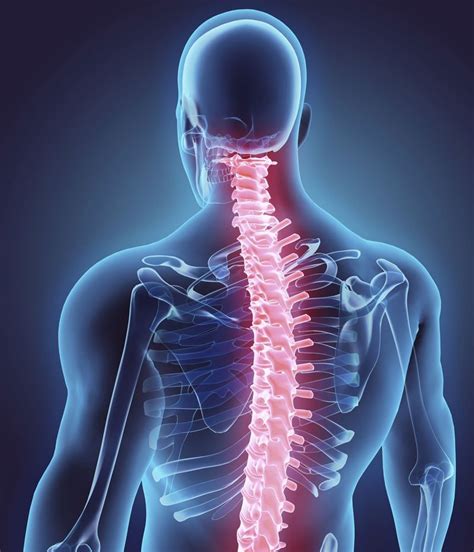 Physical Therapists Guide To Spinal Stenosis