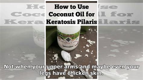 How To Easily Use Coconut Oil For Keratosis Pilaris Now Youtube