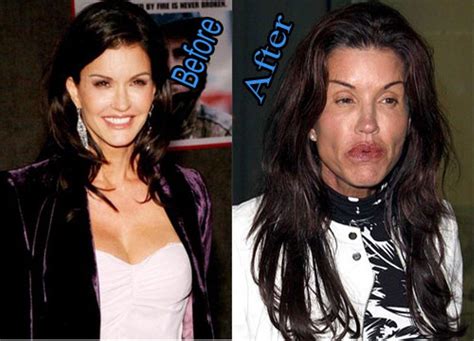 30 Celebrities Who Had Plastic Surgery Gone Wrong Wtf Buzz Grain